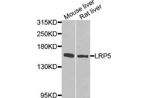 Western blot analysis of extracts of various tissues, using LRP5 antibody.