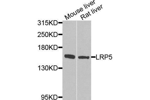LRP5 抗体  (AA 1000-1250)