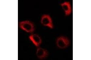Image no. 1 for anti-Golgi Membrane Protein 1 (GOLM1) antibody (ABIN2966681)