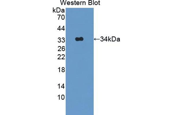 anti-Adaptor Protein, phosphotyrosine Interaction, PH Domain and Leucine Zipper Containing 1 (APPL1) (AA 404-673) antibody