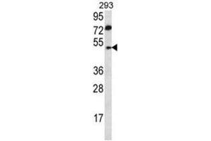 Image no. 2 for anti-Abhydrolase Domain Containing 2 (ABHD2) (AA 262-292), (Middle Region) antibody (ABIN950213)
