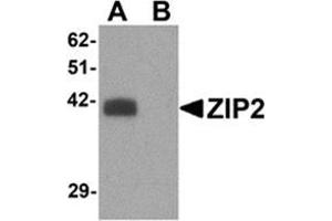 Image no. 1 for anti-Solute Carrier Family 39 (Zinc Transporter), Member 2 (Slc39a2) (N-Term) antibody (ABIN783797)
