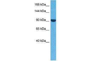 Image no. 2 for anti-Actinin, alpha 3 (ACTN3) (N-Term) antibody (ABIN2777061)