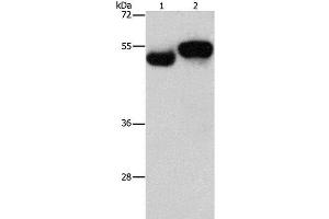 Western Blot analysis of Human fetal brain and liver tissue using AMZ1 Polyclonal Antibody at dilution of 1:1000