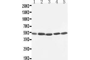 Image no. 3 for anti-Hepatitis A Virus Cellular Receptor 1 (HAVCR1) (AA 332-348), (C-Term) antibody (ABIN3044226)