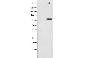 Tumor Protein p73 Antikörper  (pTyr99)