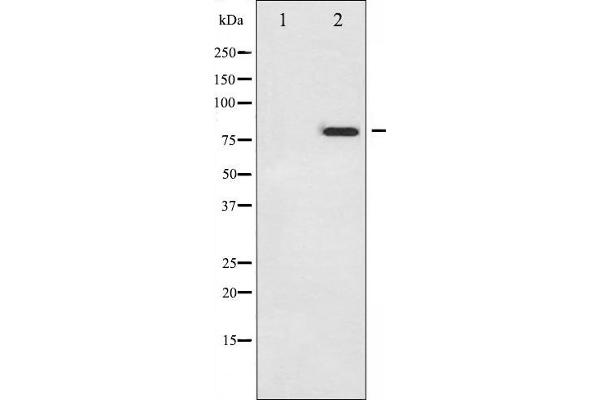 Tumor Protein p73 抗体  (pTyr99)
