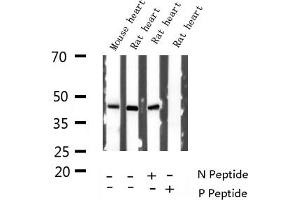 Image no. 8 for anti-GATA Binding Protein 4 (GATA4) (pSer262) antibody (ABIN6256227)