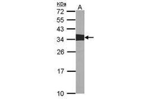 Image no. 1 for anti-V-Crk Sarcoma Virus CT10 Oncogene Homolog (Avian) (CRK) (AA 122-302) antibody (ABIN467422)
