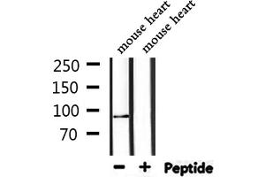 Image no. 2 for anti-Topoisomerase (DNA) I (TOP1) antibody (ABIN6257133)