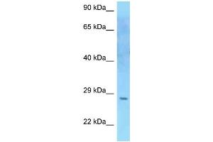 Image no. 2 for anti-Suppressor of Cytokine Signaling 2 (SOCS2) (C-Term) antibody (ABIN2789498)