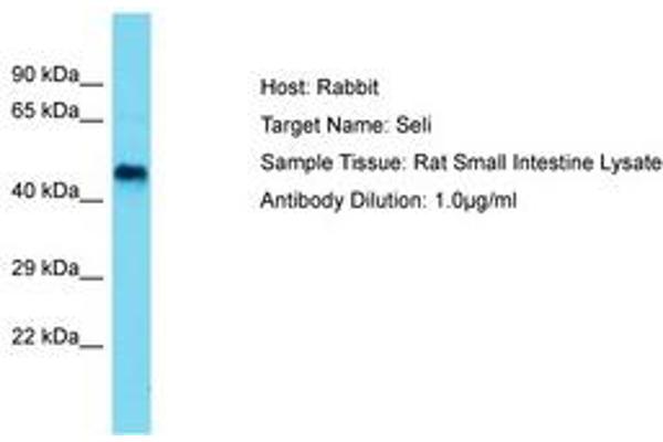 EPT1 antibody  (AA 58-107)