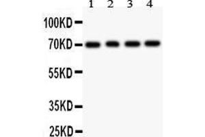 Image no. 1 for anti-Forkhead Box O1 (FOXO1) (AA 456-655) antibody (ABIN3042403)