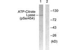 Western blot analysis of extracts from COS7 cells treated with Calyculin 50nM 30', using ATP-Citrate Lyase (Phospho-Ser454) Antibody.