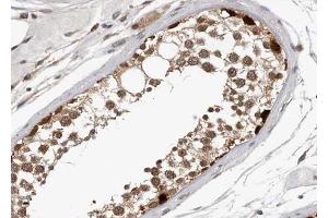 Image no. 3 for anti-V-Myb Myeloblastosis Viral Oncogene Homolog (Avian) (MYB) (pSer532) antibody (ABIN6256367)
