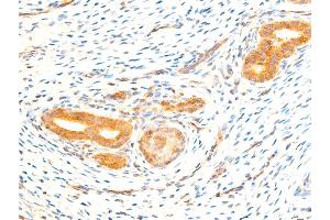 Image no. 5 for anti-Nuclear Factor-kB p65 (NFkBP65) (pSer536) antibody (ABIN6255402)