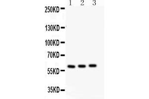 Image no. 1 for anti-Cytochrome P450, Family 11, Subfamily A, Polypeptide 1 (CYP11A1) (AA 53-66), (N-Term) antibody (ABIN5518682)