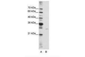 Image no. 2 for anti-EMG1 Nucleolar Protein Homolog (EMG1) (AA 51-100) antibody (ABIN6736233)