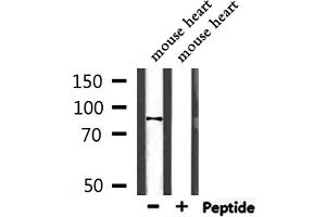 PPP1R9B Antikörper  (C-Term)