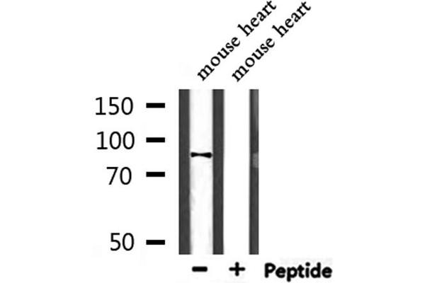 PPP1R9B Antikörper  (C-Term)