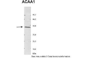 Image no. 2 for anti-Acetyl-CoA Acyltransferase 1 (ACAA1) (N-Term) antibody (ABIN2783261)