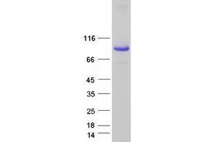 Image no. 1 for SEC14-Like 1 (SEC14L1) (Transcript Variant 1) protein (Myc-DYKDDDDK Tag) (ABIN2731557)