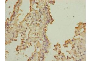 SOHLH2 antibody  (AA 1-225)