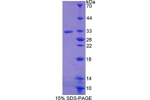 Image no. 1 for R-Spondin 3 (RSPO3) (AA 22-272) protein (His tag) (ABIN6236478)