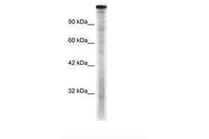 Image no. 2 for anti-TAF1 RNA Polymerase II, TATA Box Binding Protein (TBP)-Associated Factor, 250kDa (TAF1) (C-Term) antibody (ABIN6735891)