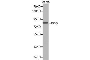 Western blot analysis of extracts of Jurkat cell line, using PPIG antibody.