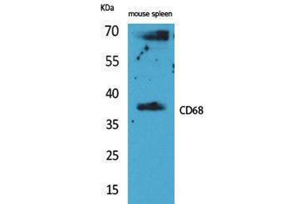 CD68 antibody  (Internal Region)