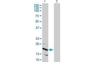 Image no. 1 for anti-Lymphocyte Antigen 96 (LY96) (AA 1-160) antibody (ABIN525339)