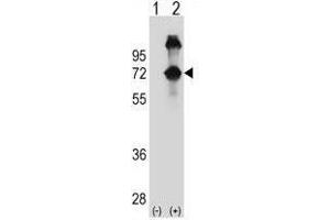 Image no. 2 for anti-Alveolar Soft Part Sarcoma Chromosome Region, Candidate 1 (ASPSCR1) (AA 64-93), (N-Term) antibody (ABIN950541)
