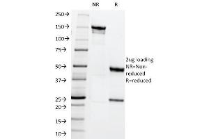 Image no. 1 for anti-ATP-Binding Cassette, Sub-Family C (CFTR/MRP), Member 1 (ABCC1) antibody (ABIN6940080)