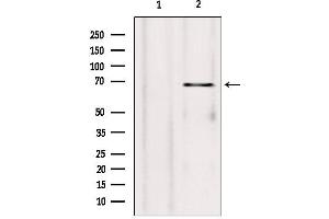 Image no. 2 for anti-Synovial Apoptosis Inhibitor 1, Synoviolin (SYVN1) (Internal Region) antibody (ABIN6265416)