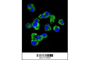 anti-Syndecan 1 (SDC1) (AA 210-238), (C-Term) antibody