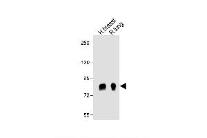 Image no. 5 for anti-Periostin (POSTN) (AA 687-716), (C-Term) antibody (ABIN655902)
