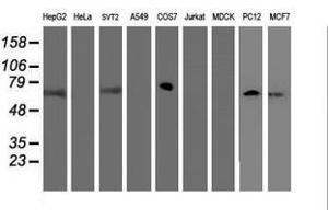 Image no. 4 for anti-F-Box Protein 21 (FBXO21) antibody (ABIN1498235)