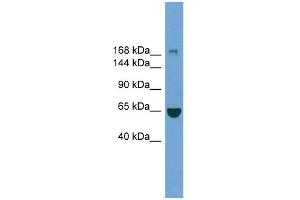 Image no. 1 for anti-Zinc Finger, CCHC Domain Containing 11 (ZCCHC11) (Middle Region) antibody (ABIN2774235)