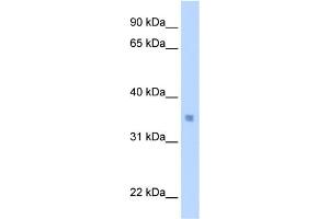Image no. 2 for anti-MAX-Like Protein X (MLX) (C-Term) antibody (ABIN2778546)