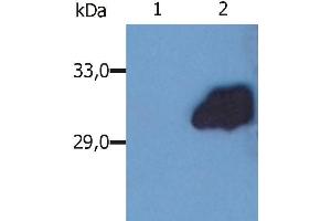 Image no. 1 for anti-Suppressor of Cytokine Signaling 3 (SOCS3) antibody (ABIN94467)