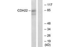 anti-Cadherin-Like 22 (CDH22) (AA 111-160) antibody