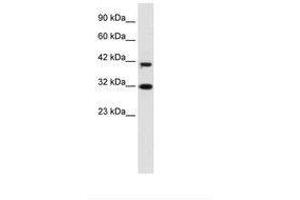 Image no. 1 for anti-D4, Zinc and Double PHD Fingers Family 1 (DPF1) (AA 229-278) antibody (ABIN6735926)