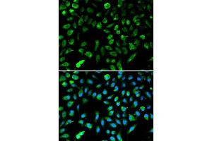 Image no. 2 for anti-Non-Metastatic Cells 1, Protein (NM23A) Expressed in (NME1) (C-Term) antibody (ABIN3020815)