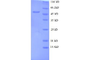 Image no. 1 for Oncomodulin (OCM) (AA 26-220) protein (GST tag) (ABIN5712698)