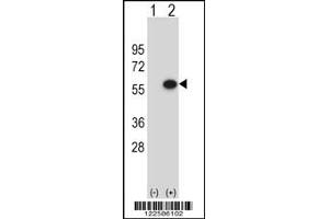 Western Blotting (WB) image for anti-ERGIC and Golgi 3 (ERGIC3) antibody (ABIN2158734)