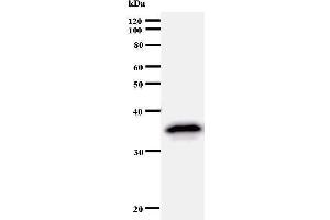 Image no. 1 for anti-Transcription Factor AP-2 alpha (Activating Enhancer Binding Protein 2 Alpha) (TFAP2A) antibody (ABIN933000)