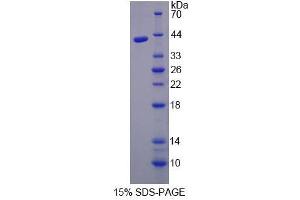 Image no. 1 for Aminolevulinate Dehydratase (ALAD) (AA 1-330) protein (His tag) (ABIN6236851)
