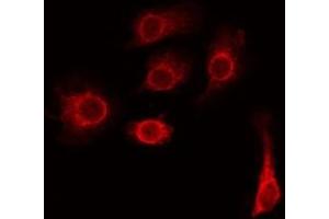 Image no. 1 for anti-Transmembrane Protein 185A (TMEM185A) antibody (ABIN6259058)