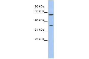 Image no. 3 for anti-Aldo-Keto Reductase Family 1, Member B1 (Aldose Reductase) (AKR1B1) (N-Term) antibody (ABIN2783262)
